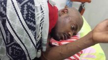 Mohamed Sleyum Ali after an alleged attack when he arrived  in Tanzania