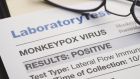 There have been 131 confirmed monkeypox cases reported outside the countries where it usually spreads. Photograph: iStock