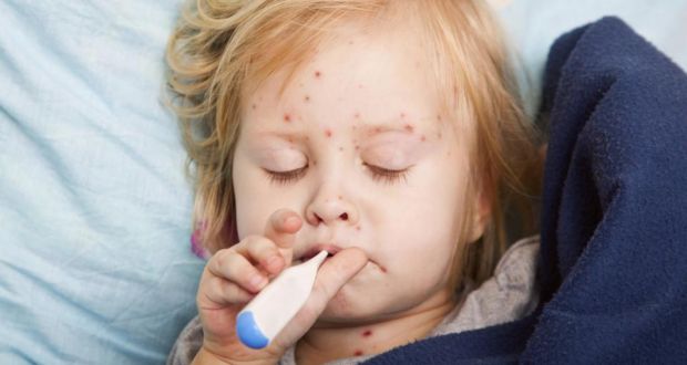 ‘California and New York are in the midst of their greatest measles outbreak in decades; 2011 saw 26,000 cases of measles in Europe, nine deaths and 7,288 hospitalisations.’ Photograph: Getty Images 