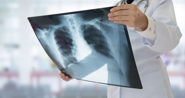 Thousands of patients across the State may need to have their medical tests redone after a major flaw was identified in the HSE computer systems. Photograph: iStock