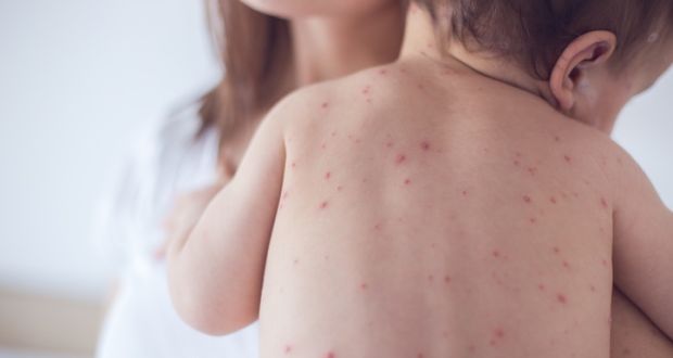 The HSE said as measles is now circulating in the community, it is important that everyone be aware of the possible risk of spread whenever groups of people gather.  Photograph: iStock