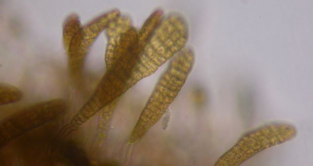 Microscopic Alaria plantlets 18 days post spraying 