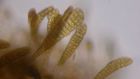 Microscopic Alaria plantlets 18 days post spraying 