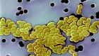 Drug-resistant bacteria of the Enterococcus genus. Photograph: Janice Carr/CDC/ Science Photo Library
