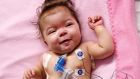 Critically ill infant undergoing mechanical ventilation via a tube in her windpipe at Children’s Hospital of Philadelphia
