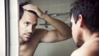 Hair loss can occur for a variety of reasons, such as pattern baldness or as a result of stress or illnesses. Photograph: iStock