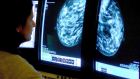 File photograph of a consultant analysing a mammogram. File photograph: Rui Vieira/PA Wire