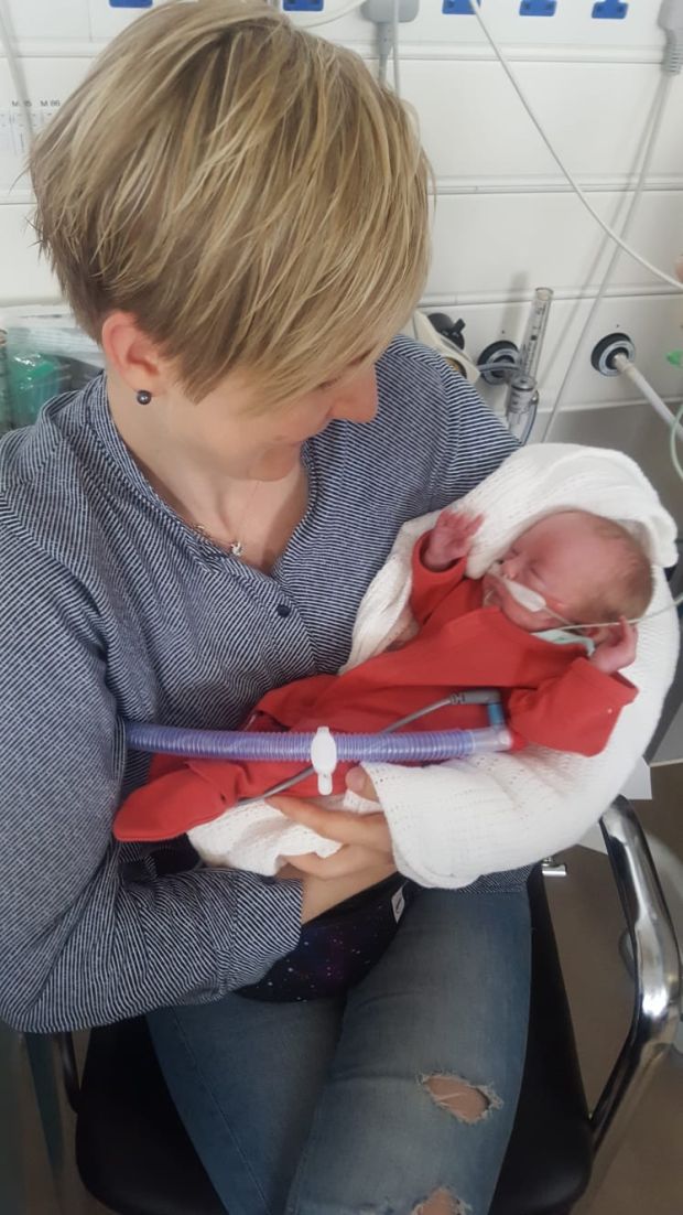 Born At 23 Weeks What Saved Sara Was That She Was Over 500g
