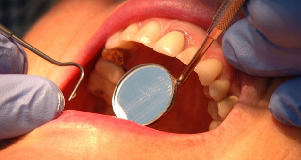Mouth health often reflects general health, according to  Prof Leo Stassen, president of the Irish Dental Association. Photograph: John Giles/PA Wire 