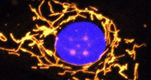 A fluorescent microscope image of a healthy cell with its mitochondria highlighted in gold. It shows a highly elaborate and well-connected network of mitochondria. Image:  Prof Jane Farrar and Dr Daniel Maloney, Trinity College Dublin