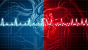 Atrial fibrillation is an irregular and often rapid heart rhythm – arrhythmia – that can lead to blood clots in the heart. Photograph: iStock
