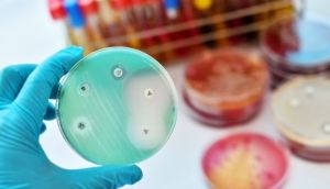 Research indicates antimicrobial resistance (AMR) is now a leading cause of death worldwide, and the number could potentially be much higher