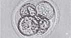 An early-stage embryo. Photograph: Newcastle University