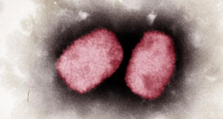 A sample of the monkeypox virus under a microscope. Photograph: Andrea Maennel, Andrea Schnartendorff/RKI Robert Koch Institute/AFP via Getty 