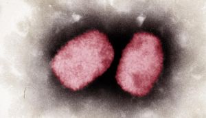 A sample of the monkeypox virus under a microscope. Photograph: Andrea Maennel, Andrea Schnartendorff/RKI Robert Koch Institute/AFP via Getty 