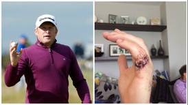 Jamie Donaldson suffers severe  finger injury in chainsaw mishap