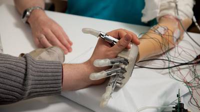 Prosthetic hand brings old sensation back to amputee