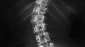 Crumlin hospital only provider of spinal rods at centre of recall