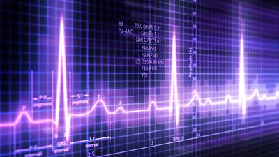 Medtch firm Fire1 raises €40m to develop remote heart monitor