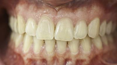 Government’s oral health policy fundamentally flawed, says dental body