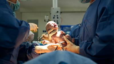 Rate of Caesarean sections and inductions increasing for first-time mothers