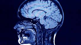 Sub-concussive blows can cause brain injury, says Trinity research