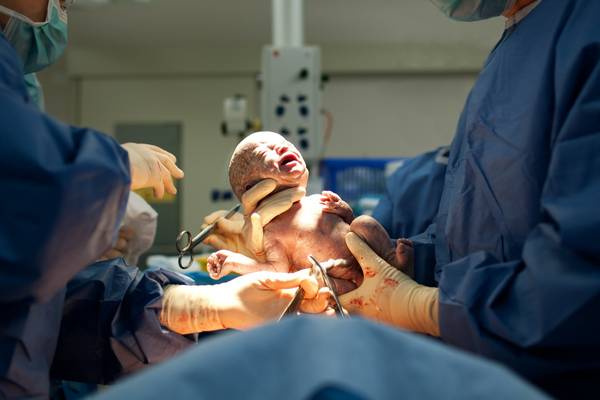 Rate of Caesarean sections and inductions increasing for first-time mothers