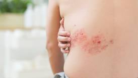 ‘I wouldn’t wish it on anyone’: What to know and do about shingles