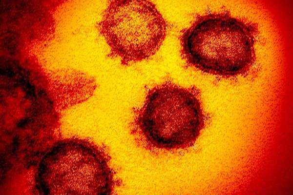 Coronavirus: Two more deaths and 156 further cases in the State