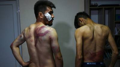 Two Afghan journalists beaten after being detained by Taliban