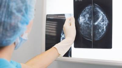 Wealthier people more likely to avail of cancer screening, says ESRI