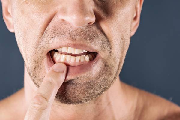 Gum disease bug ‘central’ to development of Alzheimer’s, says study