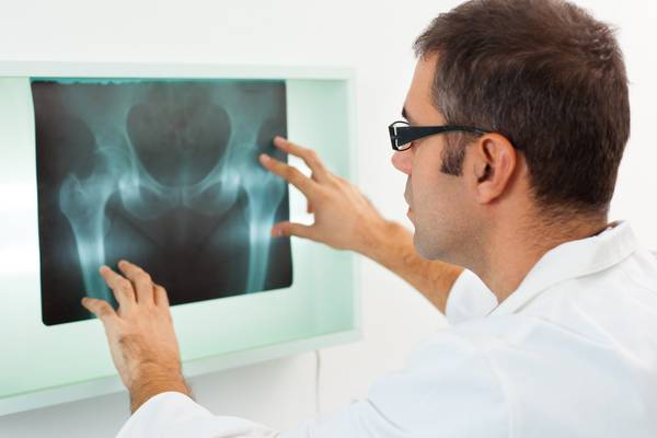 Over 25% of hip fracture patients wait more than two days for surgery