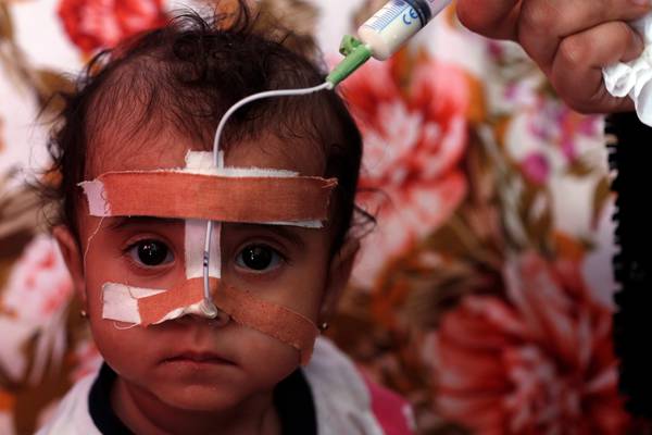 Yemen facing major famine as lack of funds forces aid cuts