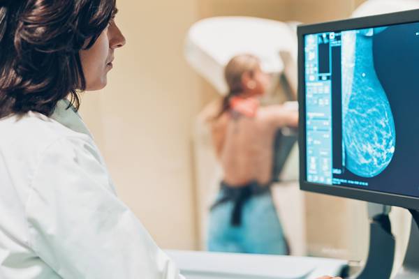 BreastCheck screenings fell by more than two-thirds in 2020
