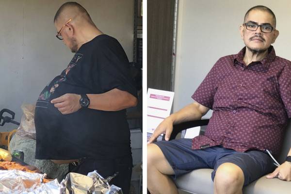 It wasn’t a beer belly – it was a tumour the size of a baby rhino