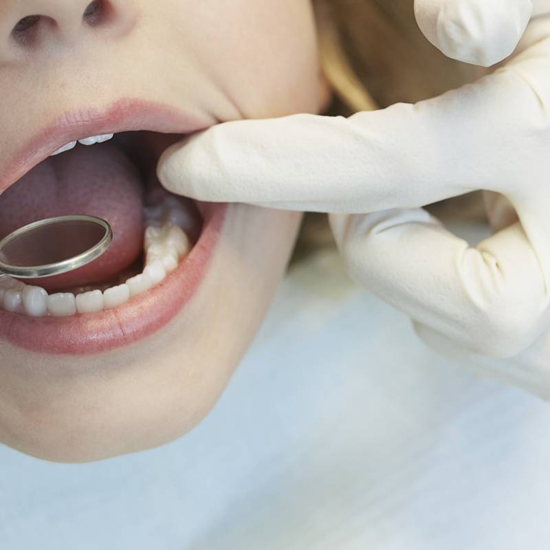 Over 100,000 children ‘denied’ school dental screening appointments last year