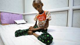 More than one million children starve as Yemen war rages