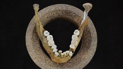 Development of farming lead to crooked teeth