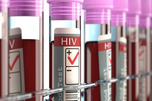 Irish rate of HIV diagnoses highest in western Europe