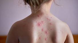 Chickenpox vaccine could be added to childhood immunisation schedule
