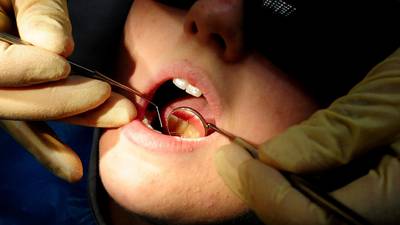 Free dental care plan would cost €80m a year, ESRI says