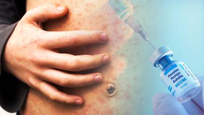 Fifth case of measles confirmed in the State as HSE steps up vaccination programme