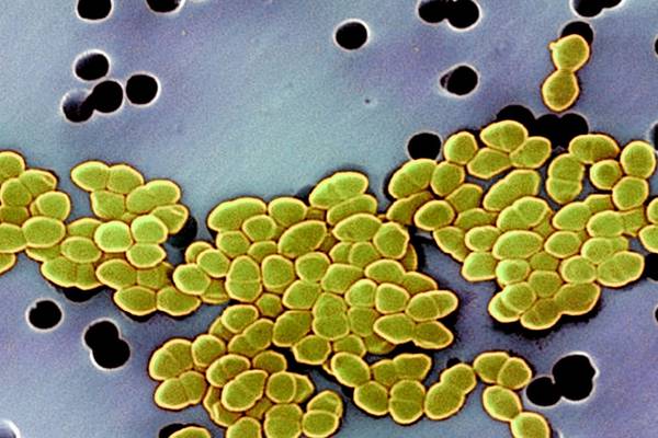 Hundreds of patients not told they had come into contact with superbug