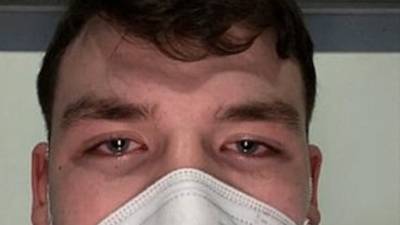 Coronavirus: 17-year-old ‘shocked’ over hospitalisation