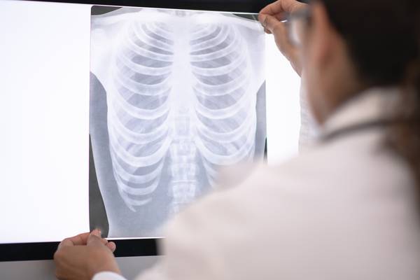 Lung cancer: Under half of patients seen on time in major hospital
