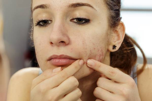 Acne sufferers can experience lower quality of life due to perceived stigma – study