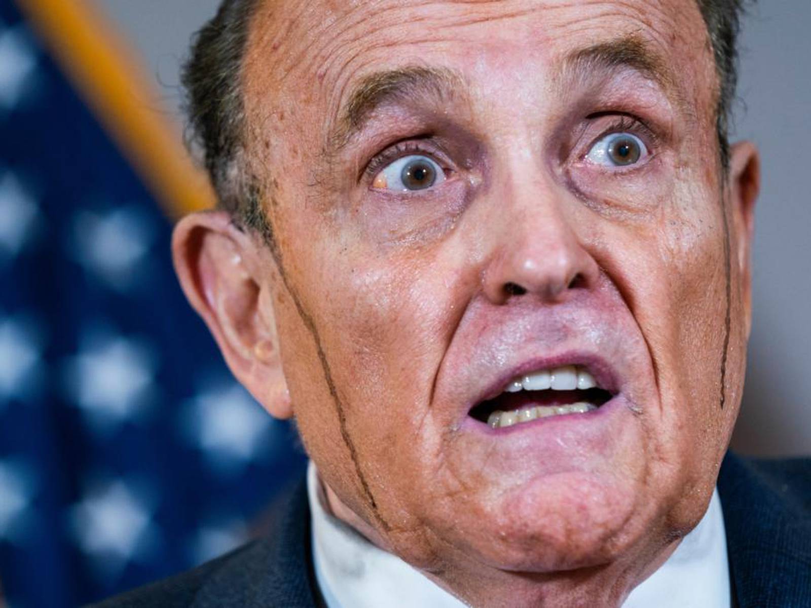 What caused Rudy Giuliani's bizarre hair malfunction? – The Irish Times