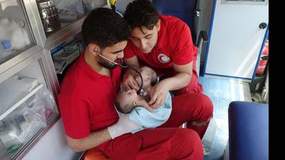 Doctors seek help after conjoined twins born in Syria war zone