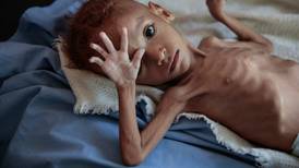 85,000 children may have died of hunger in Yemen, charity says